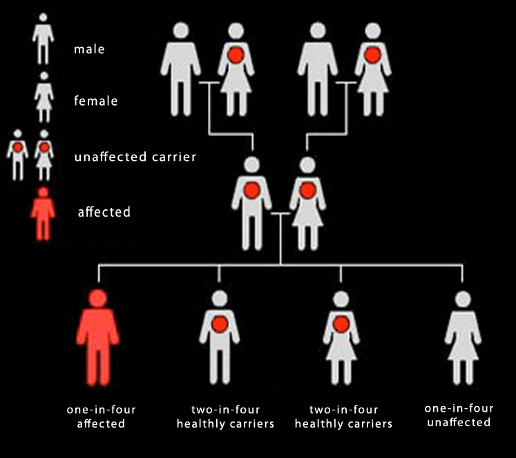 sickle cell diagram